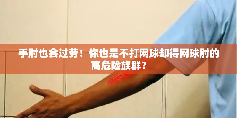 手肘也会过劳！你也是不打网球却得网球肘的高危险族群？
