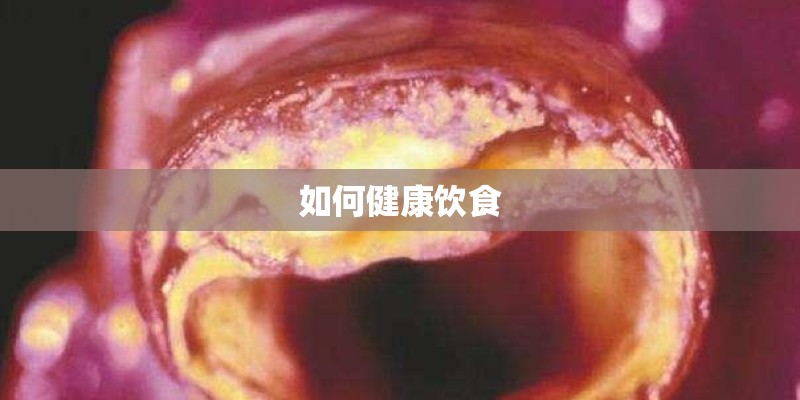 如何健康饮食 如何健康饮食