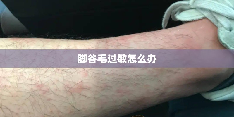 脚谷毛过敏怎么办