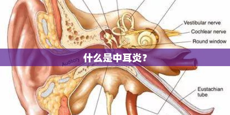 什么是中耳炎？