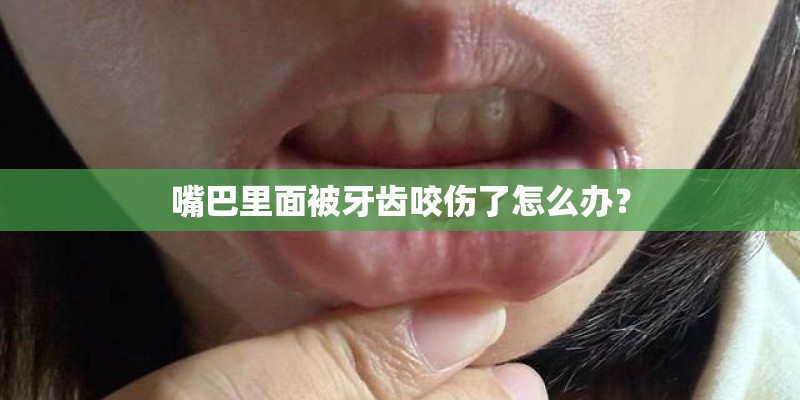嘴巴里面被牙齿咬伤了怎么办？